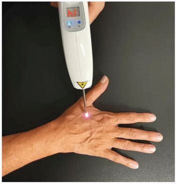 Laser-no-Ponto-Intestino-Grosso 461368.jpg